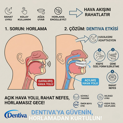Dentiva Horlama Engelleyici Ağızlık