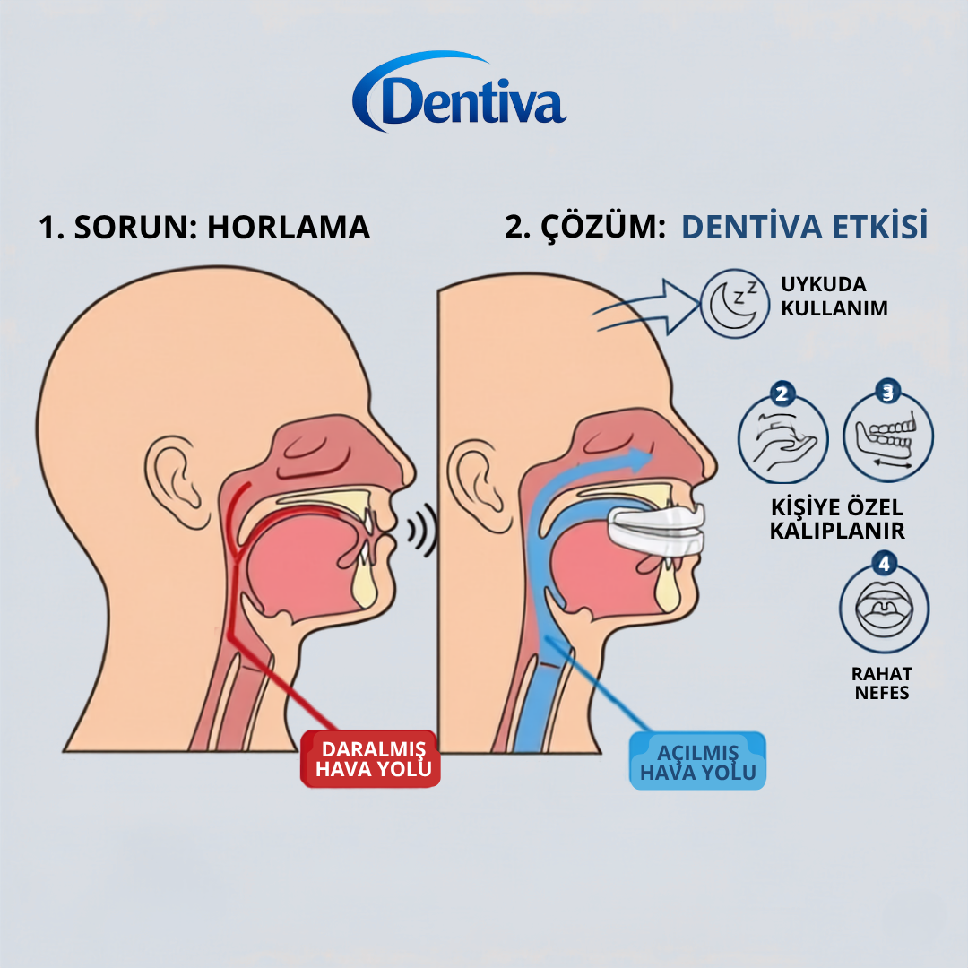Dentiva Horlama Engelleyici Ağızlık A